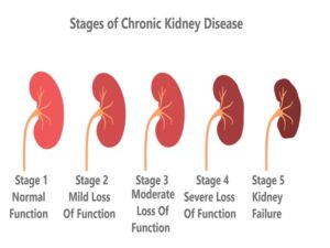 Chronic Kidney Disease