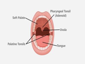 Adenoidectomy Cost in India
