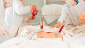 Bone-marrow-transplant-technology