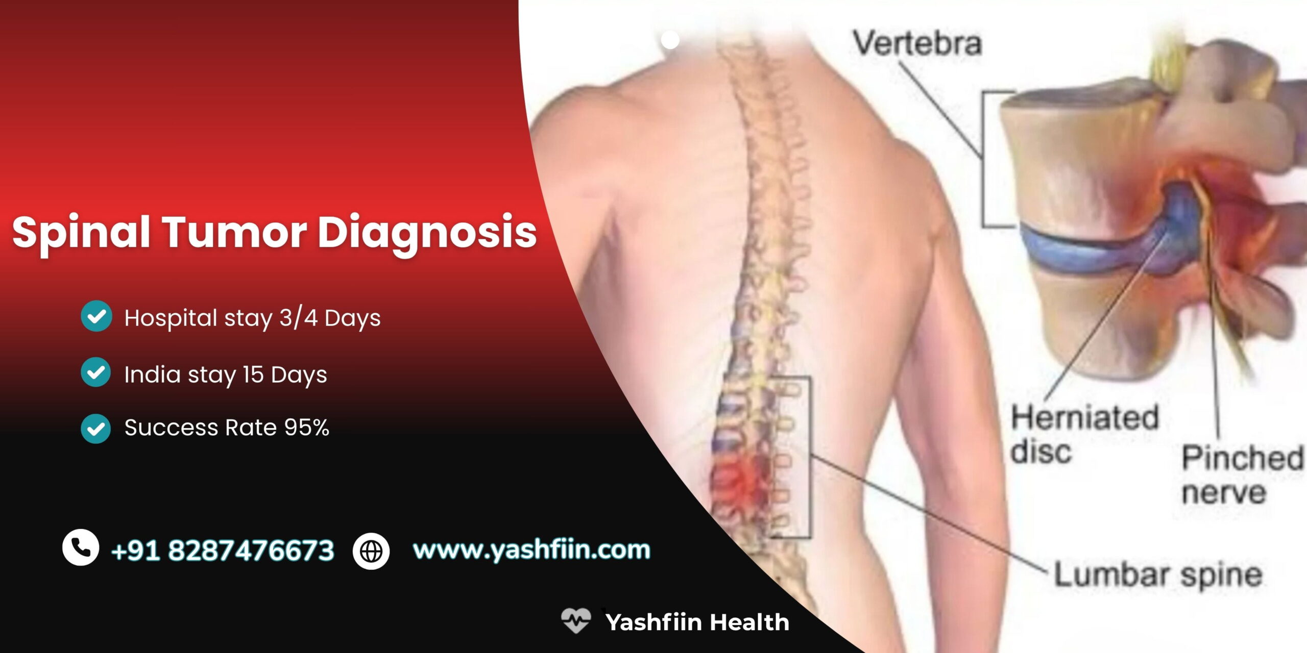 Procedure Image