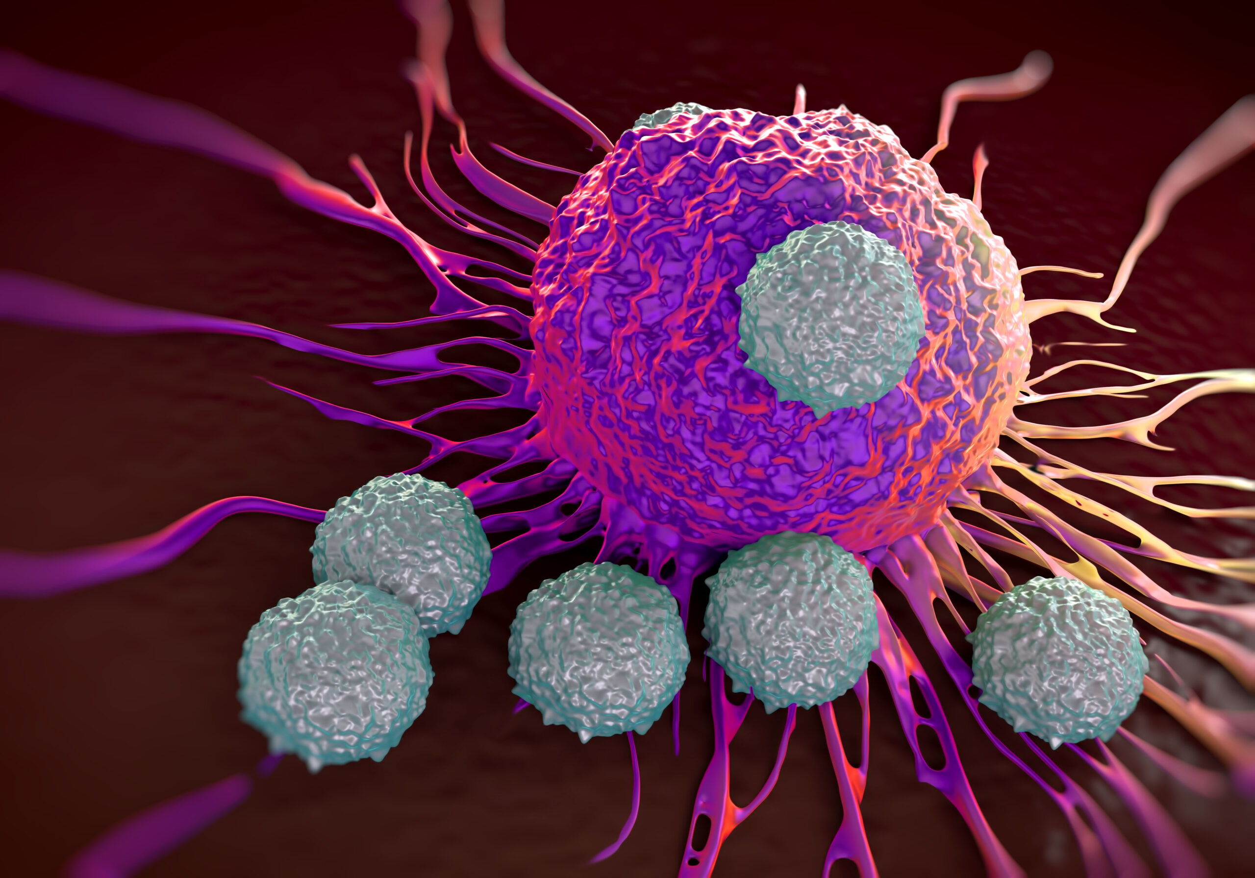 Donor Lymphocyte Infusion