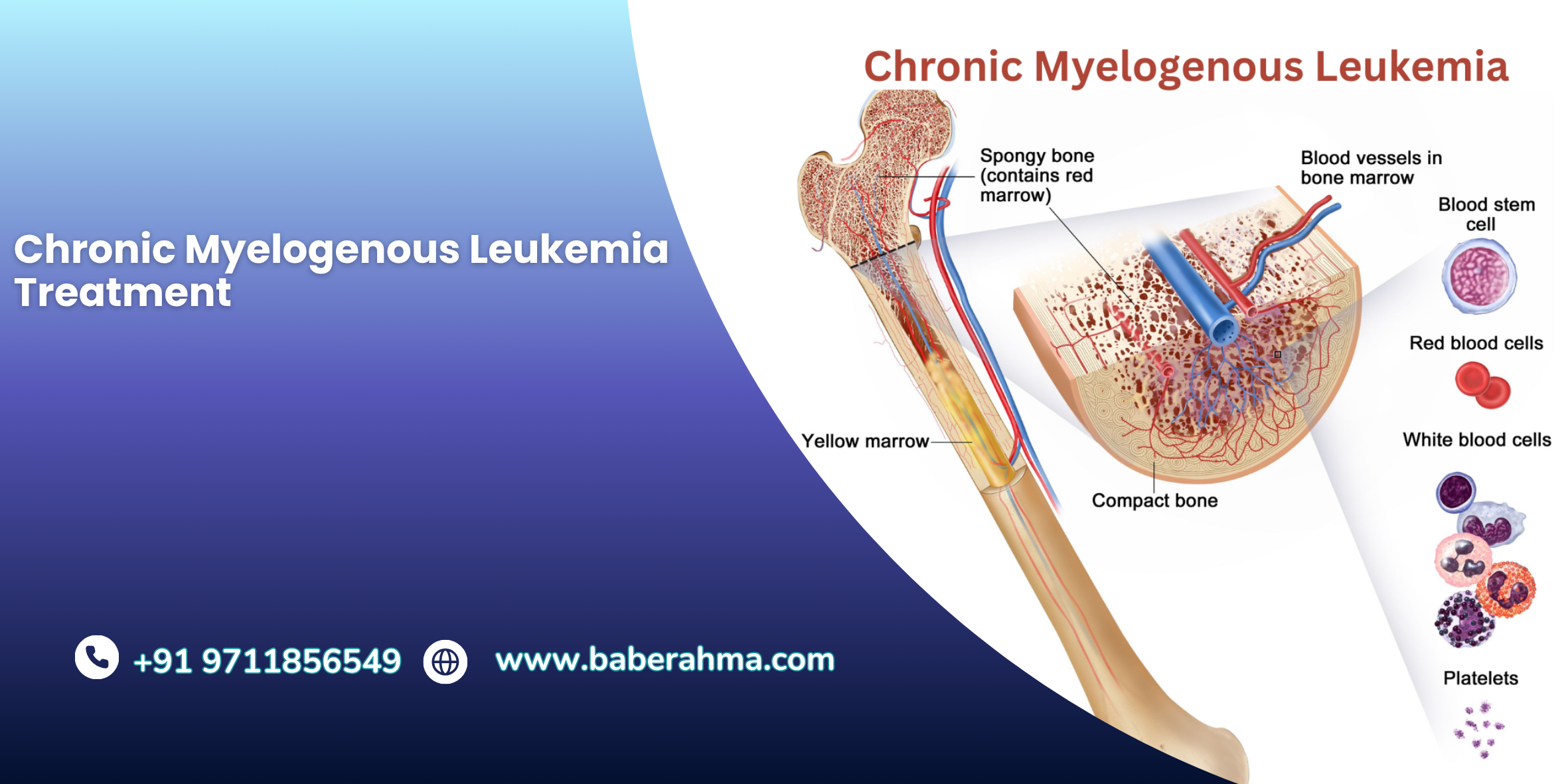 Procedure Image
