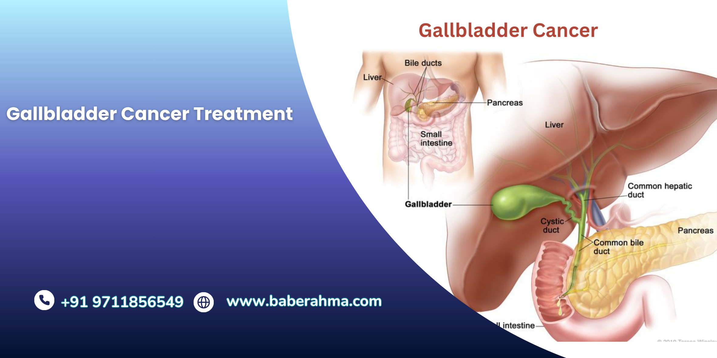 Procedure Image