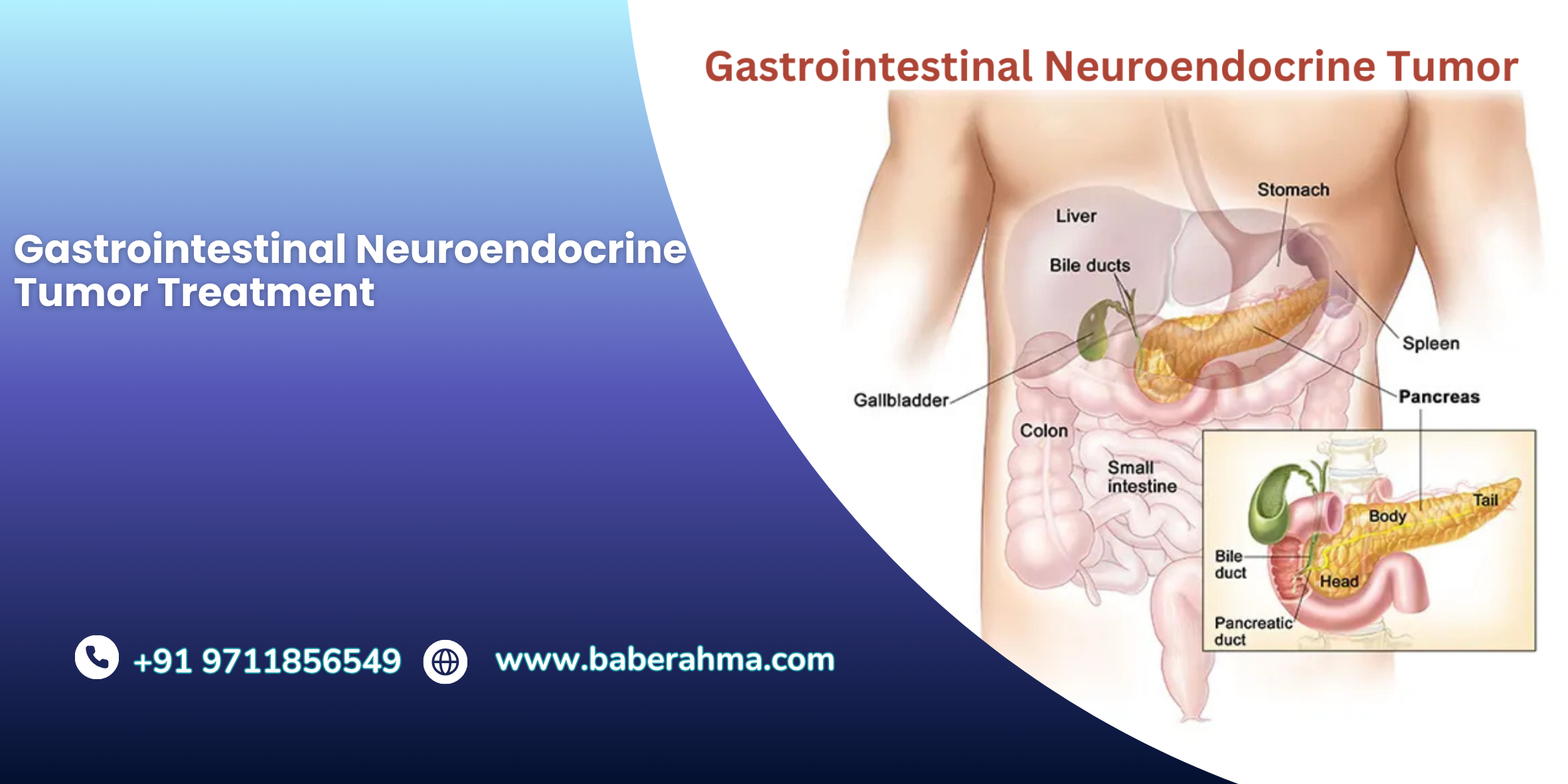 Procedure Image