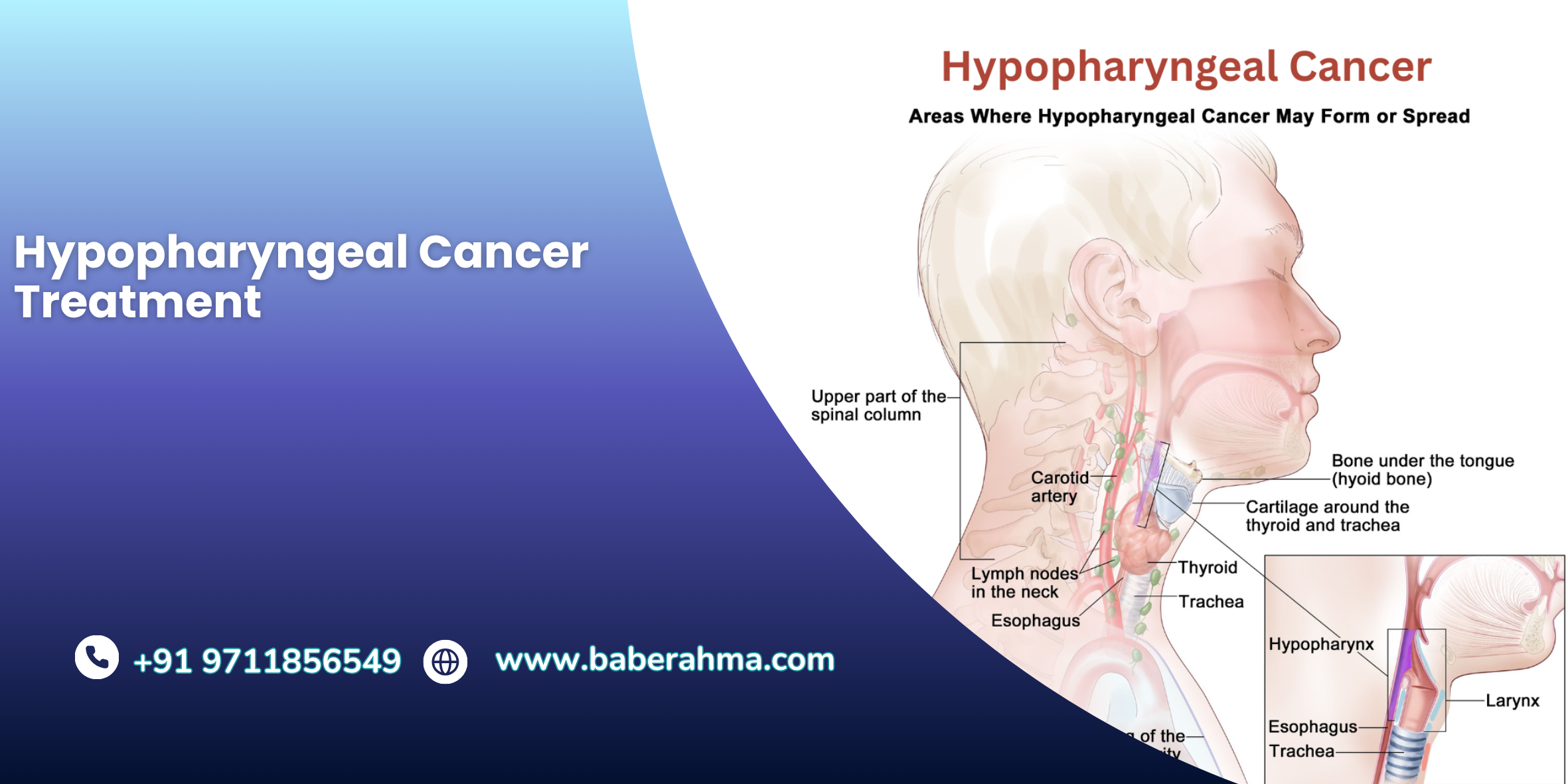 Procedure Image