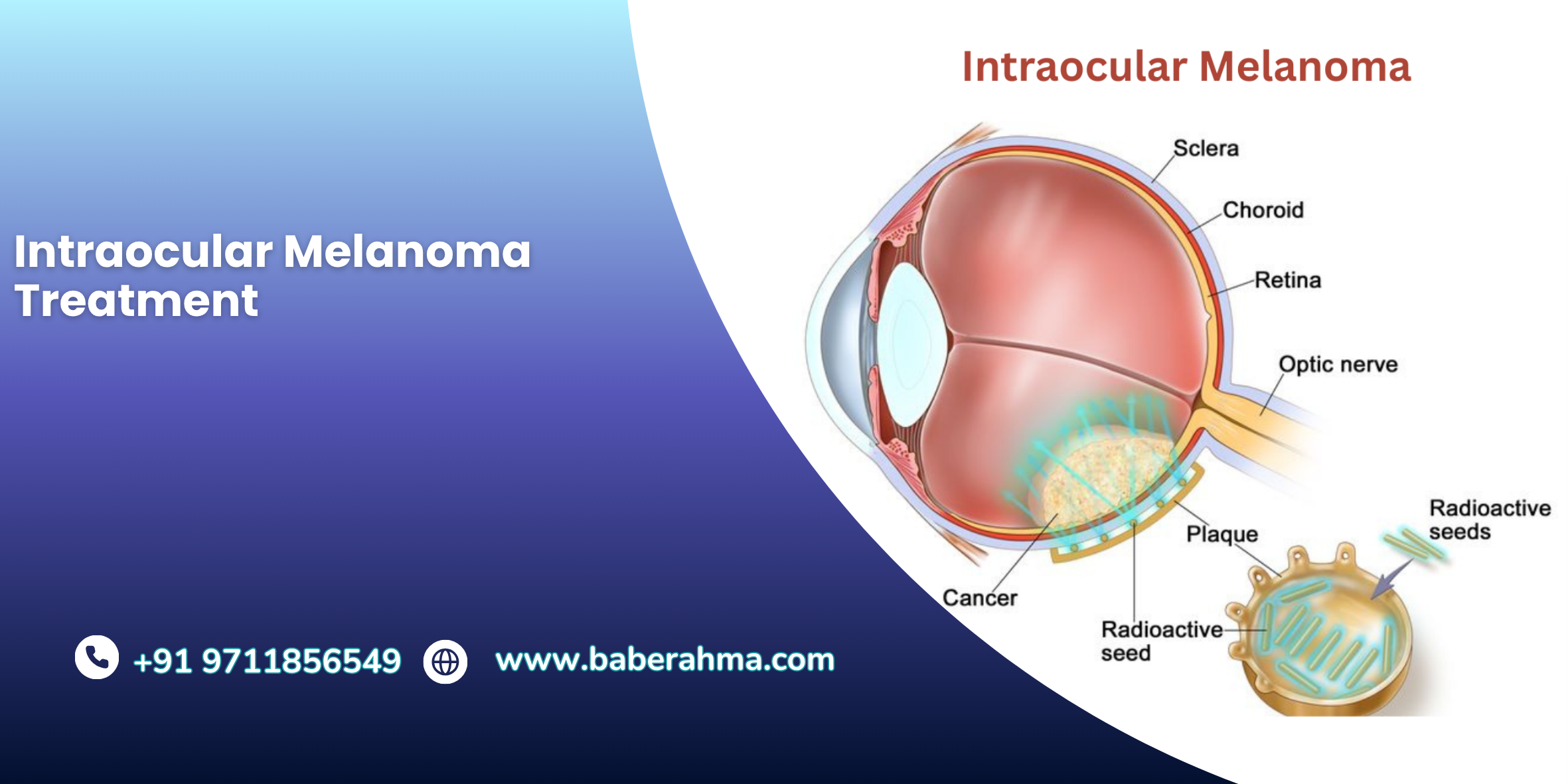 Procedure Image