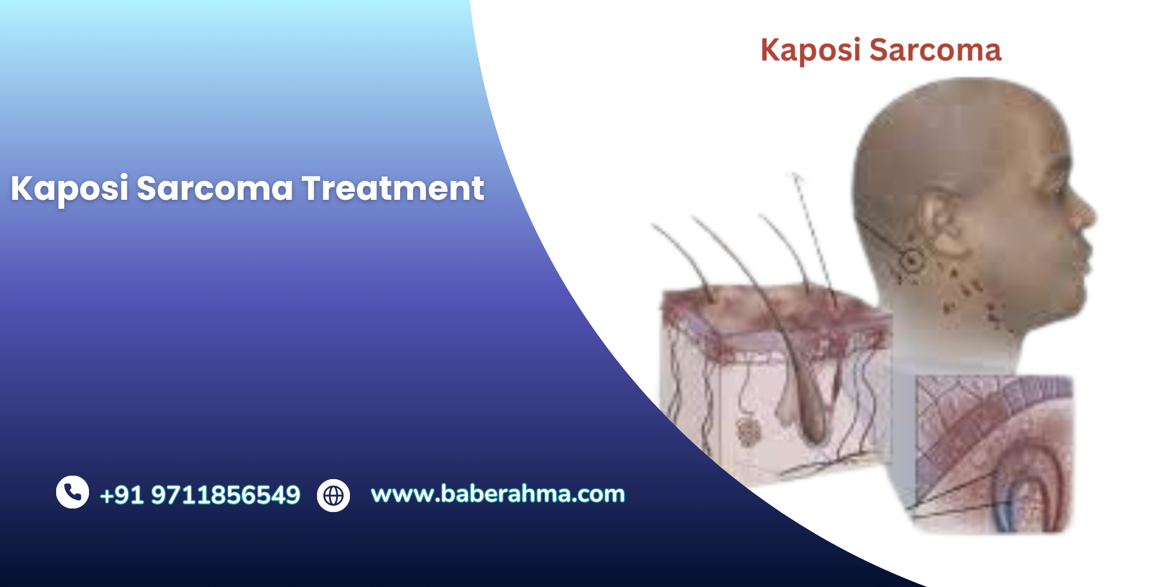 Procedure Image