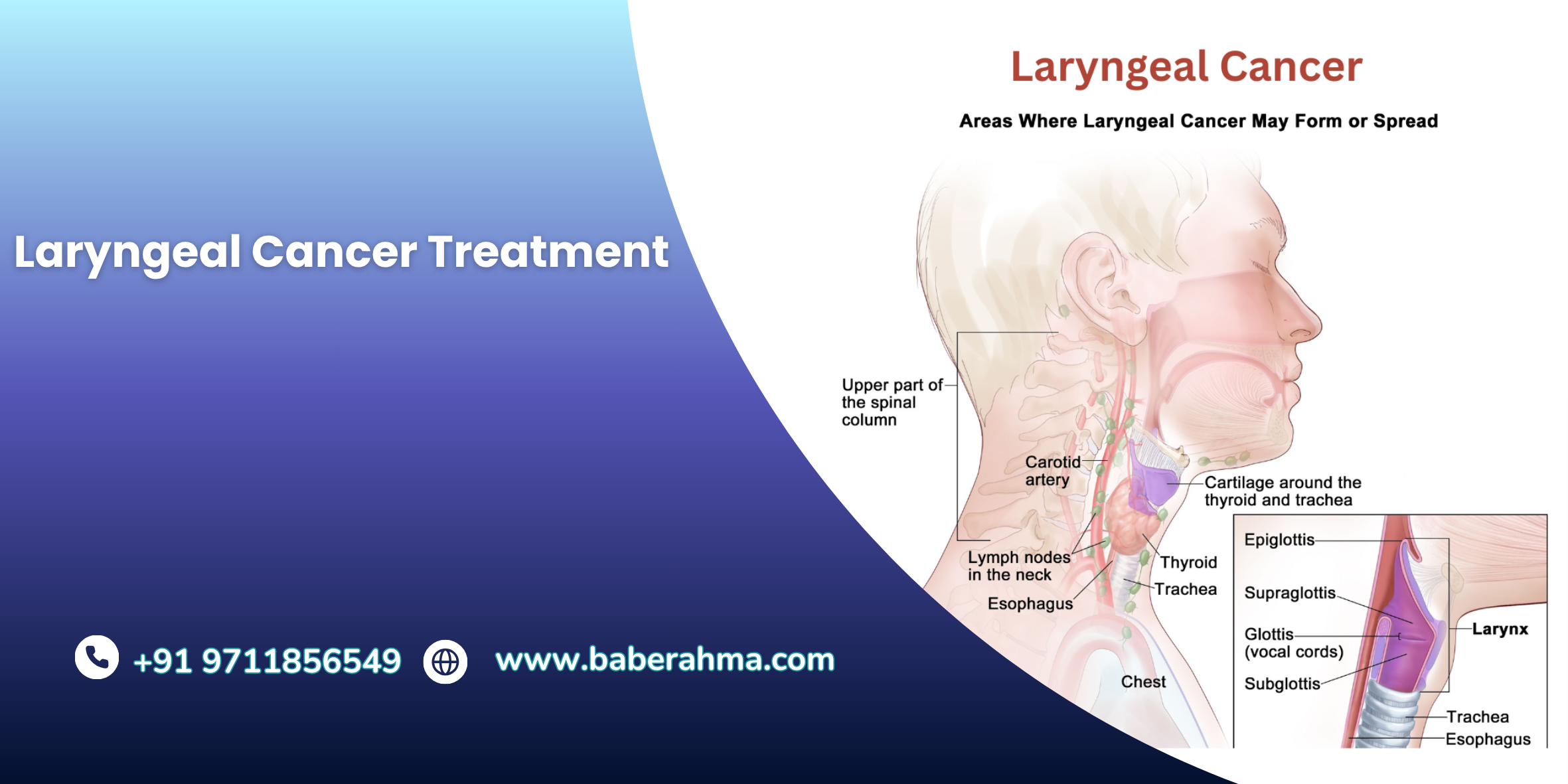 Procedure Image