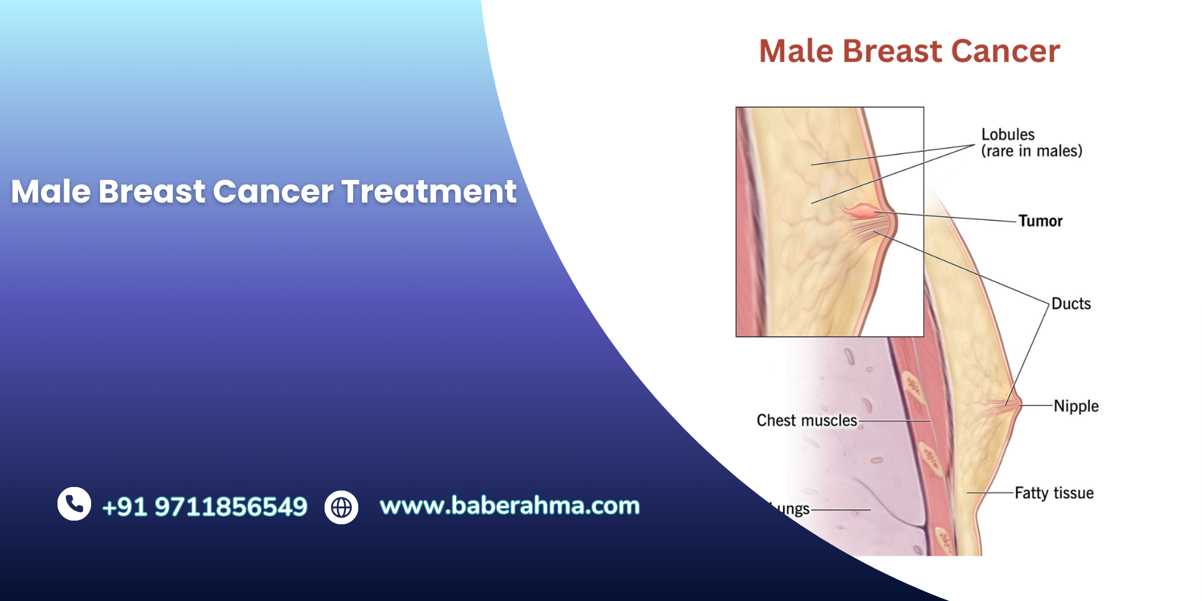 Procedure Image