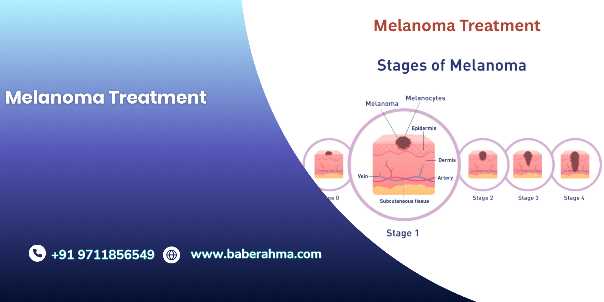 Procedure Image