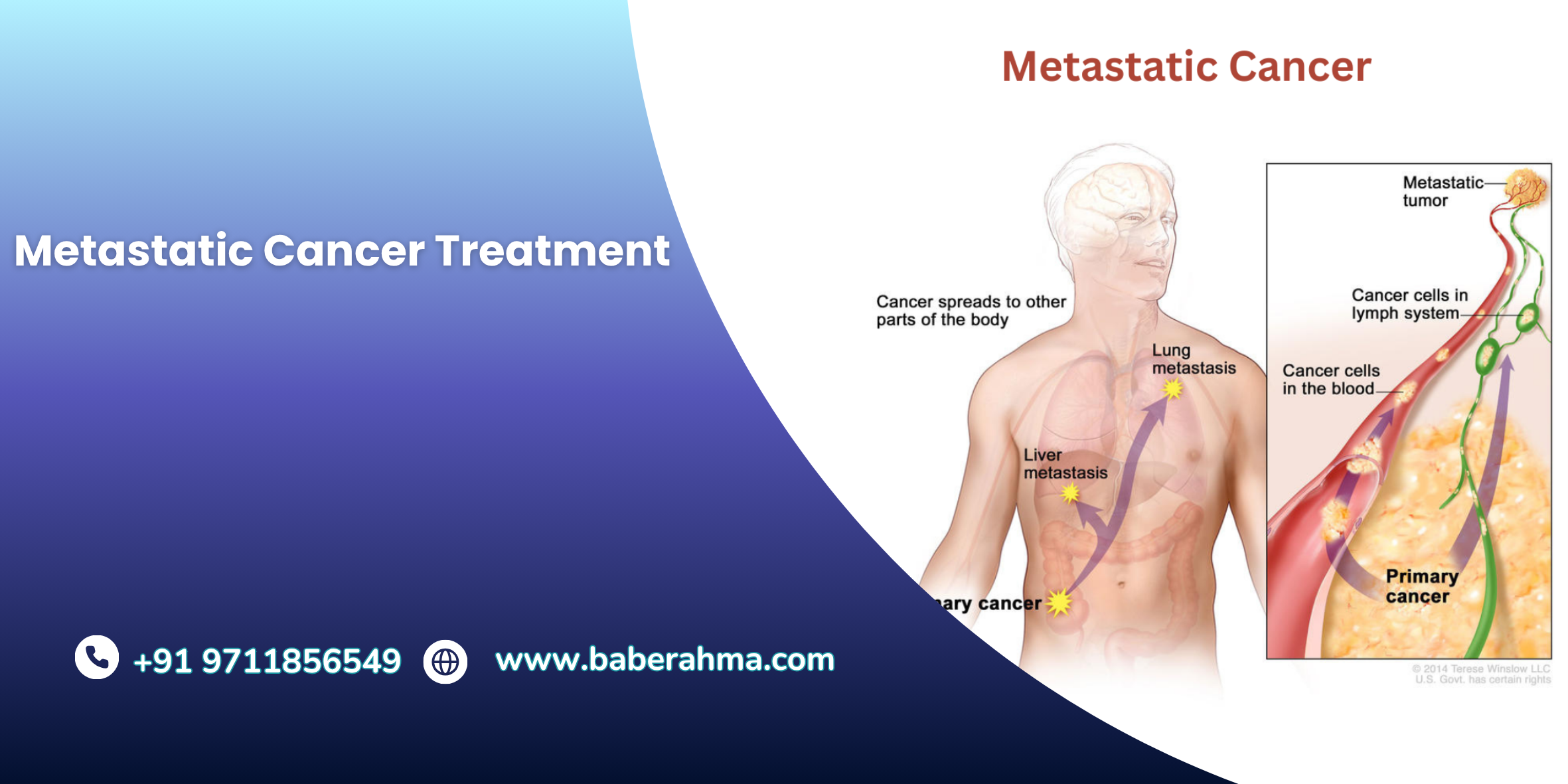 Procedure Image