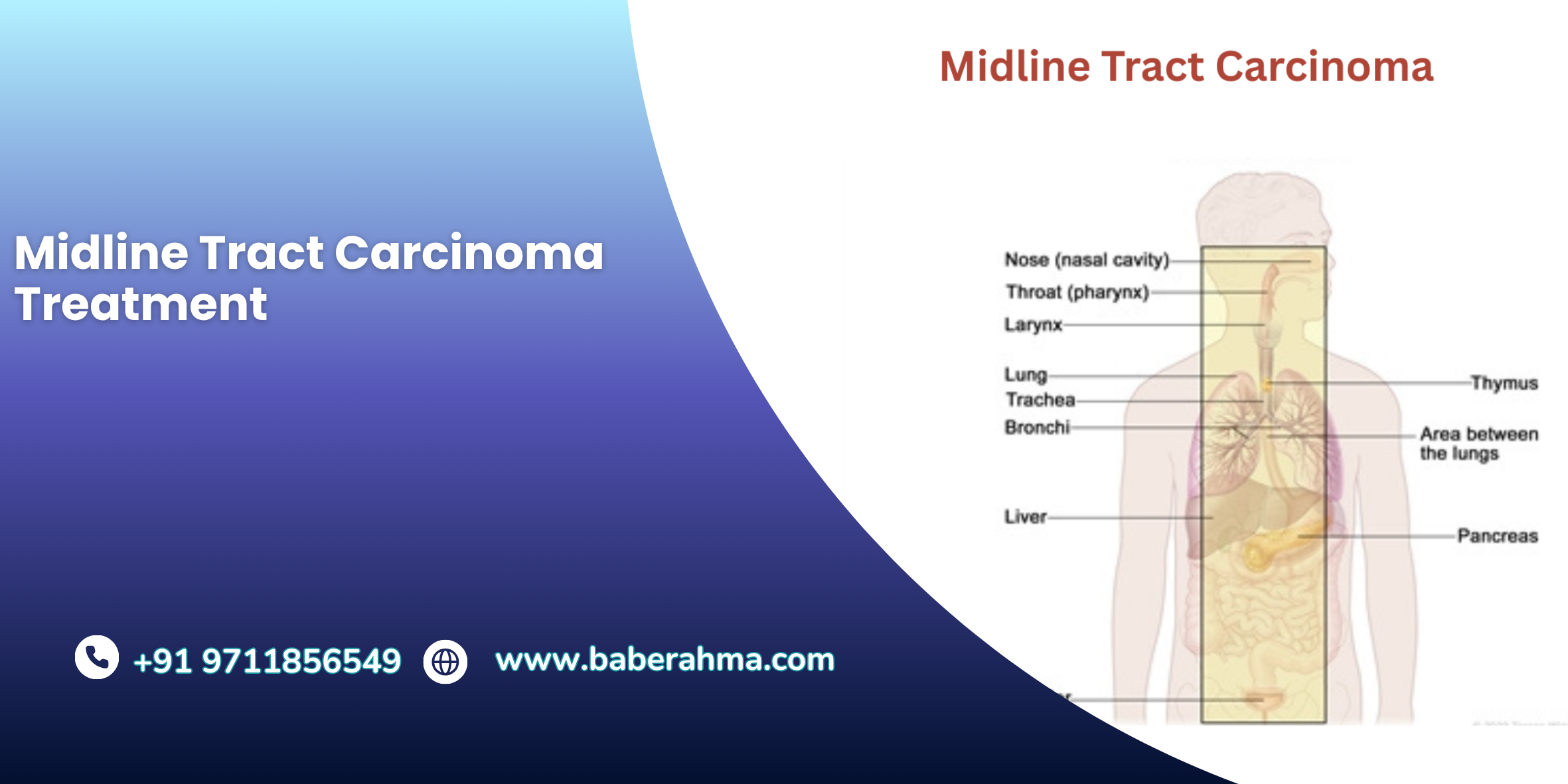 Procedure Image