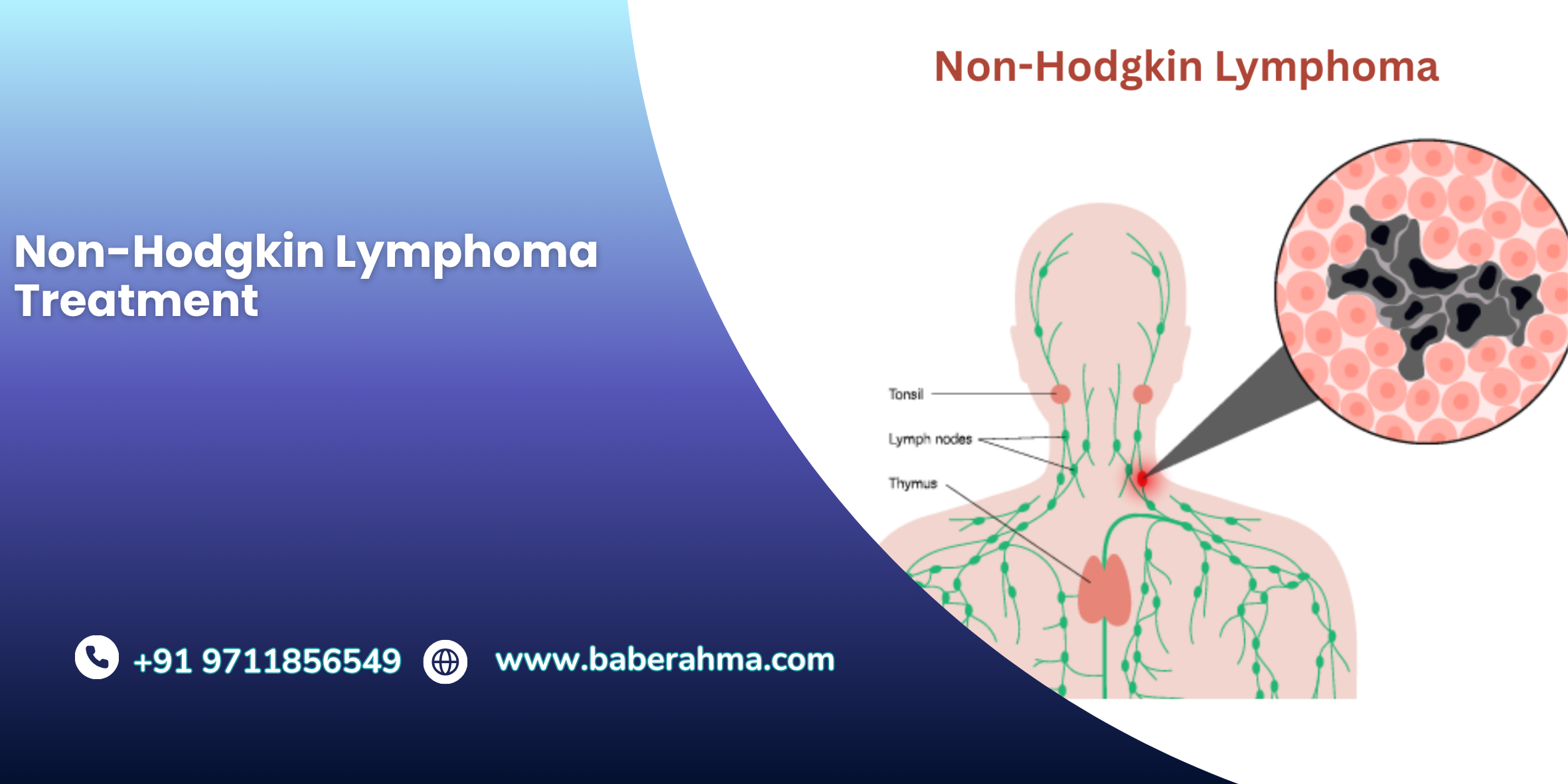 Procedure Image