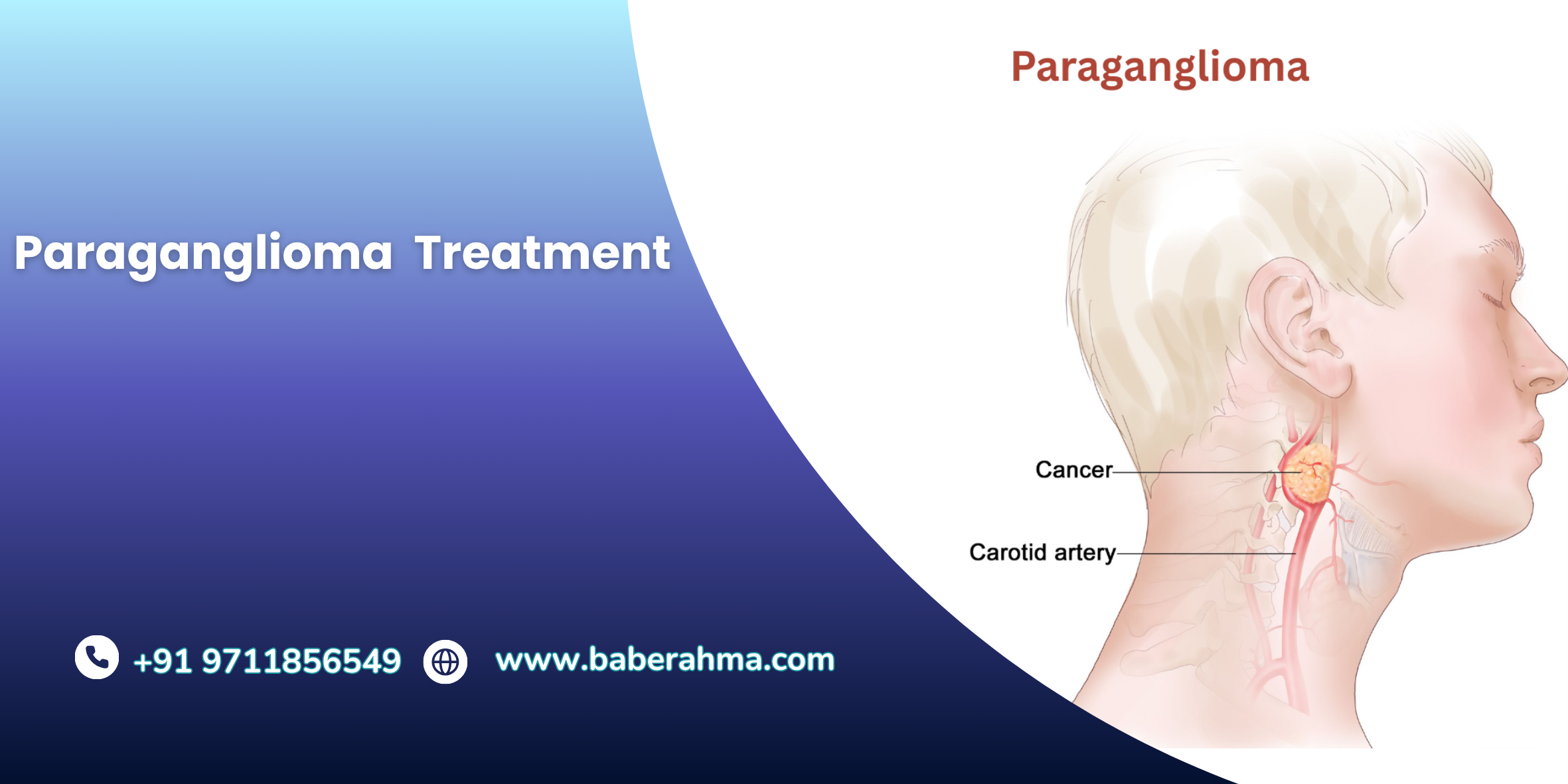 Procedure Image