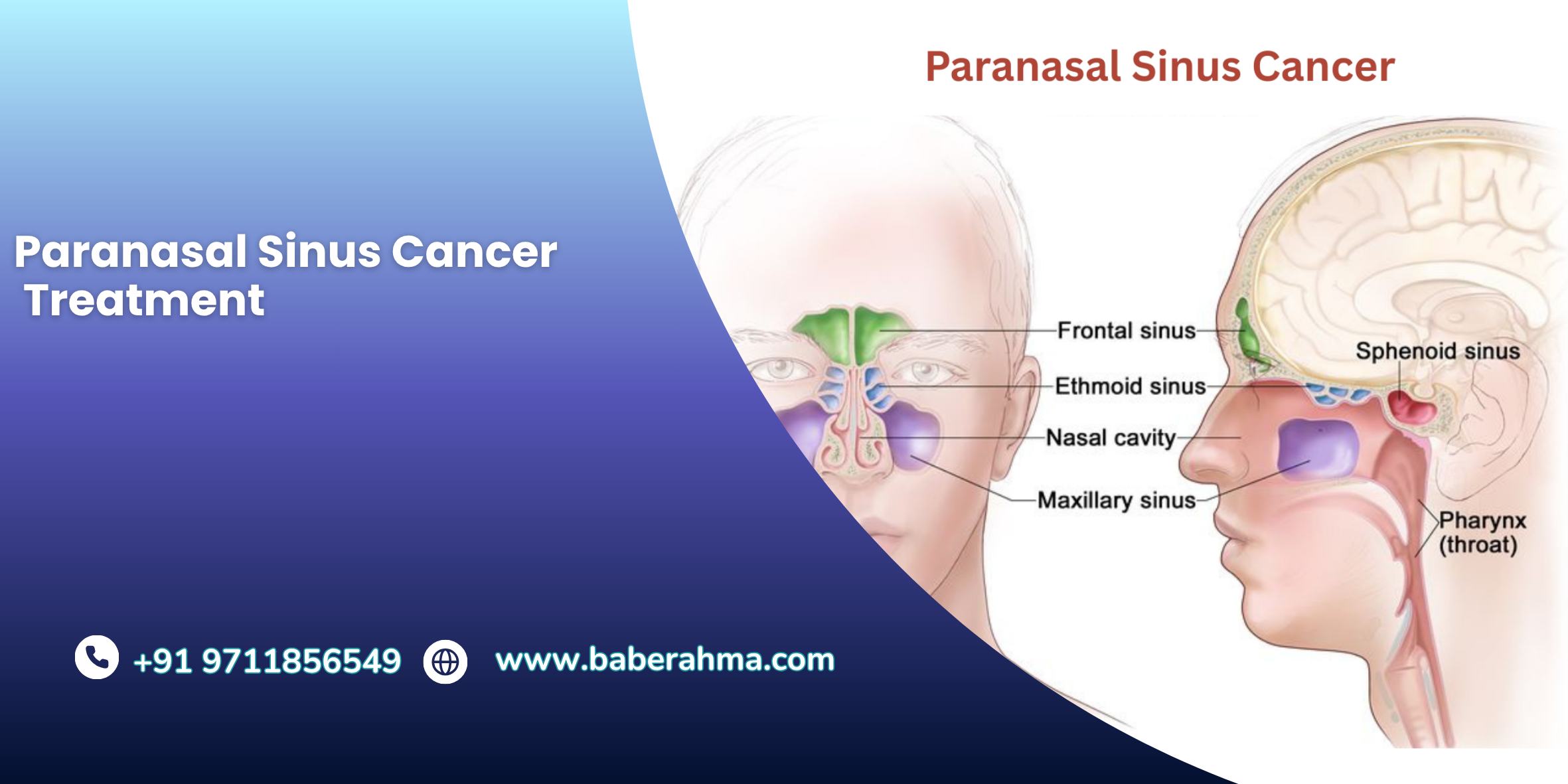 Procedure Image
