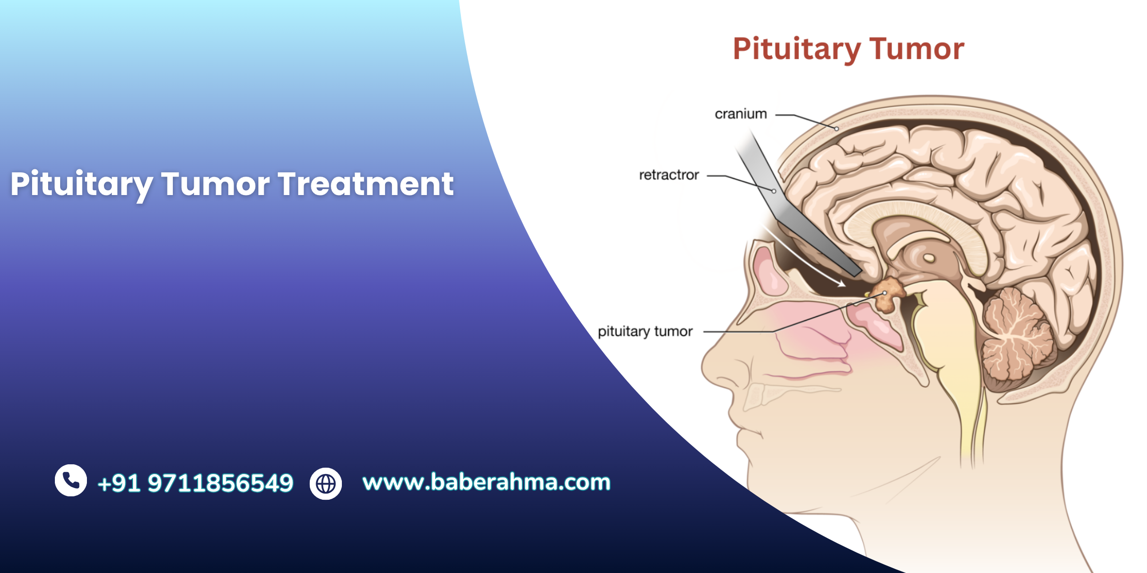 Procedure Image