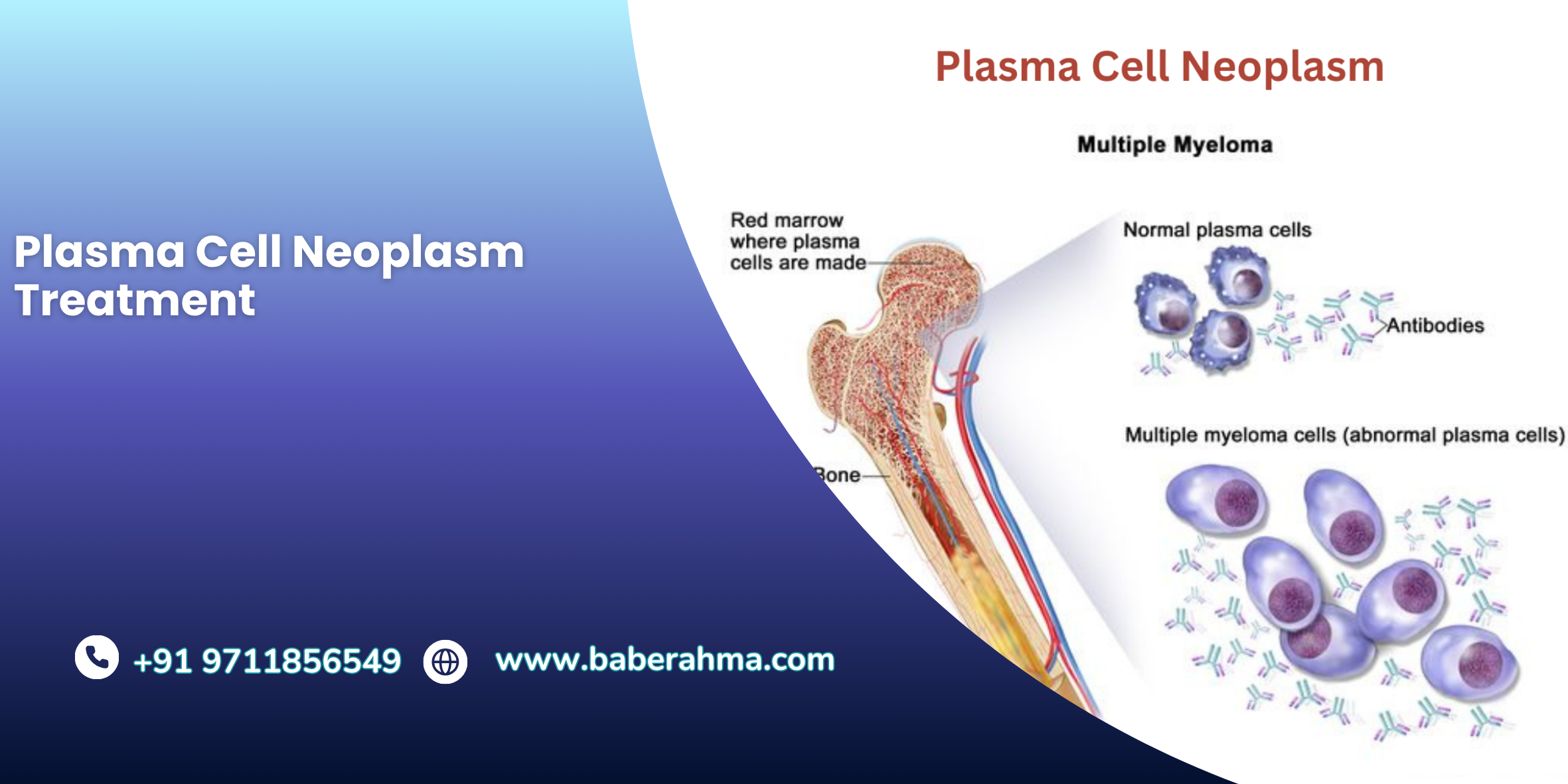 Procedure Image