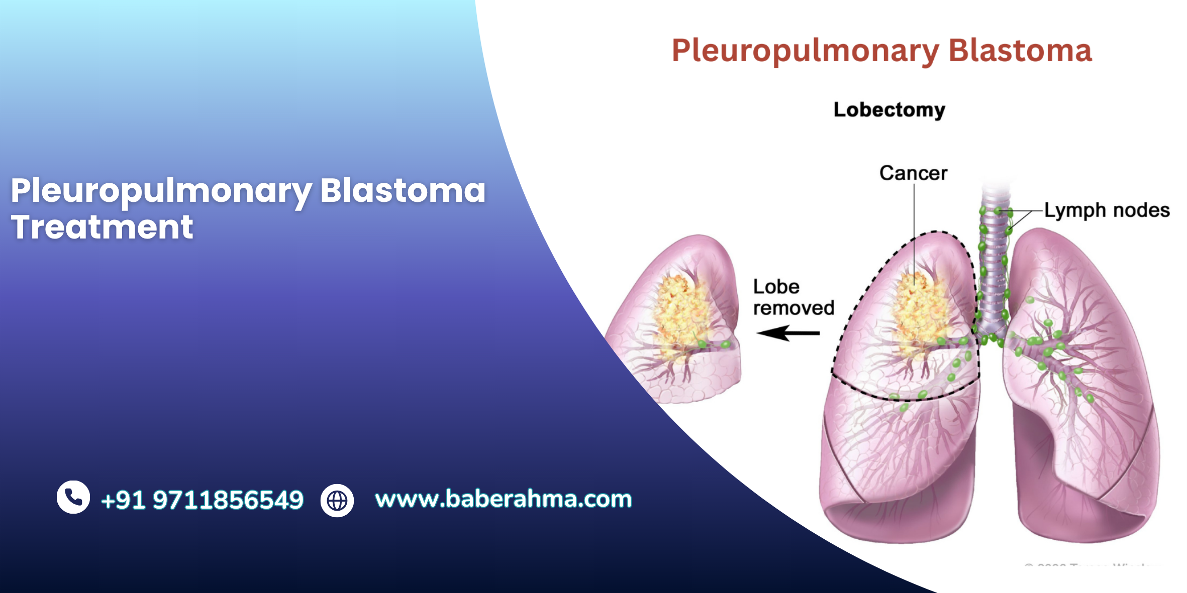 Procedure Image