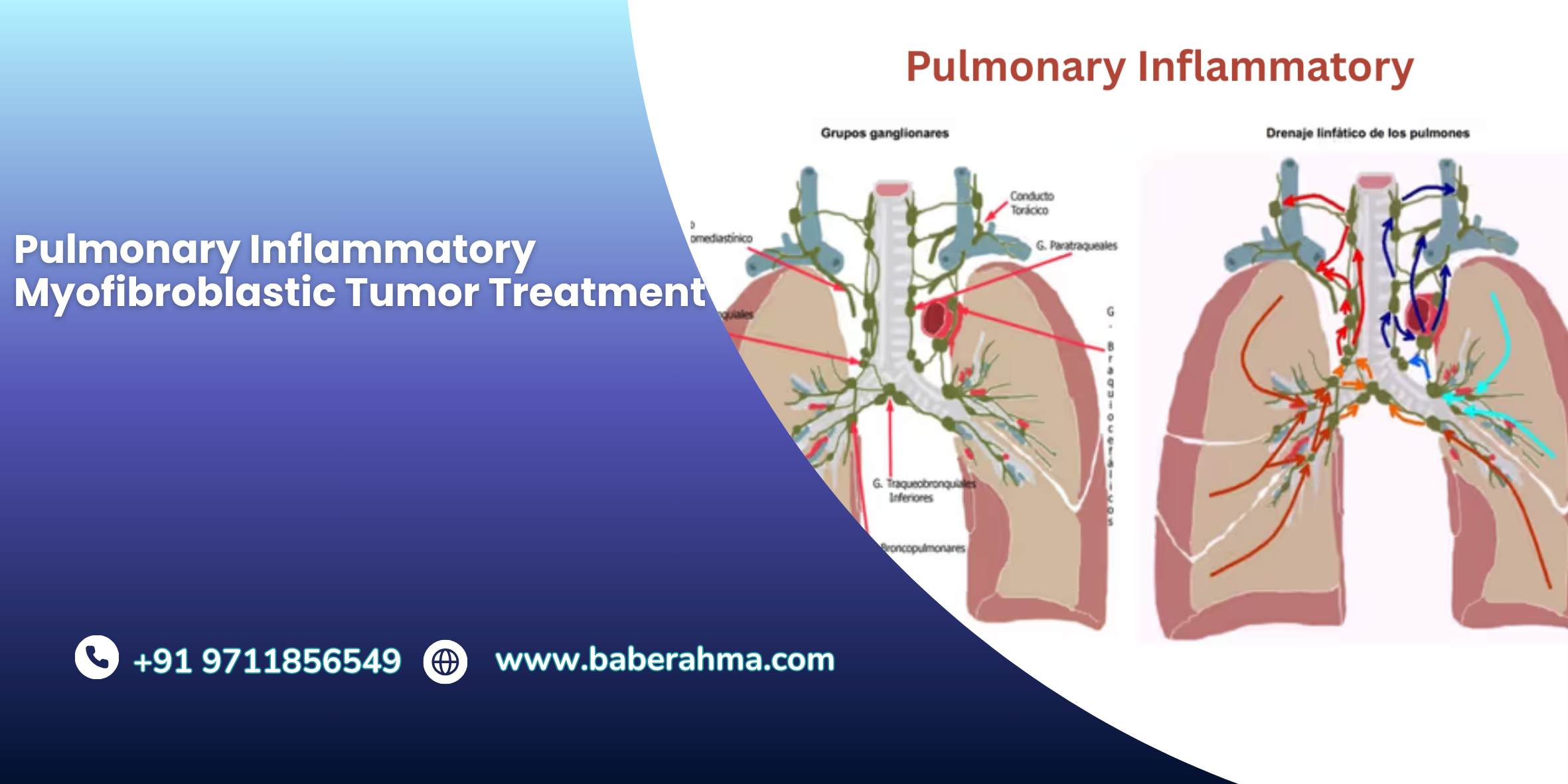 Procedure Image