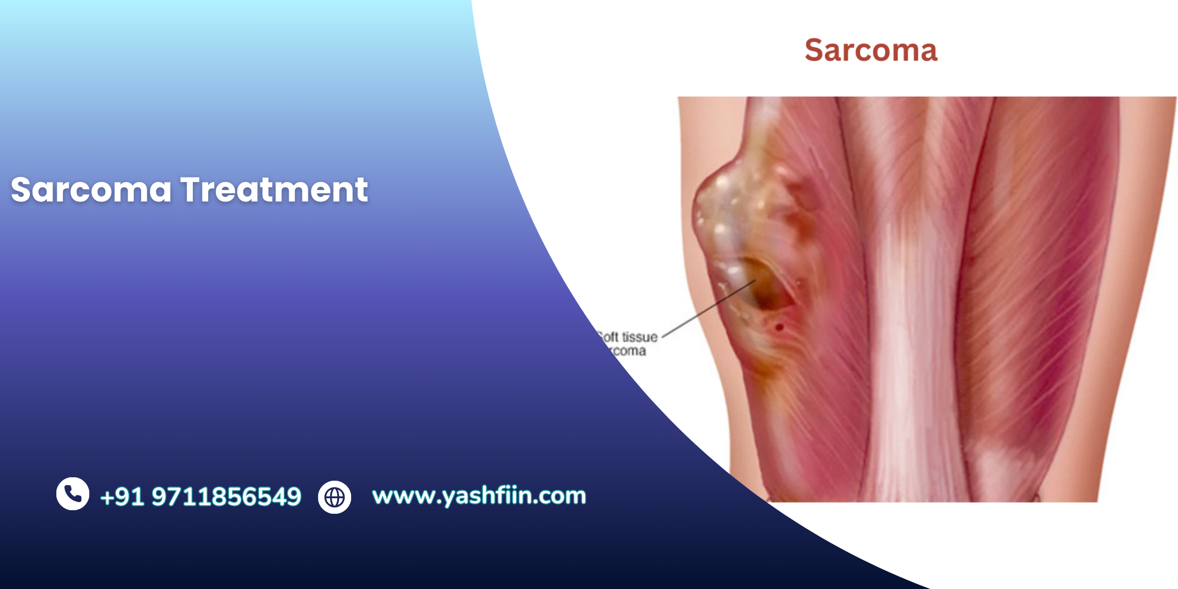 Procedure Image