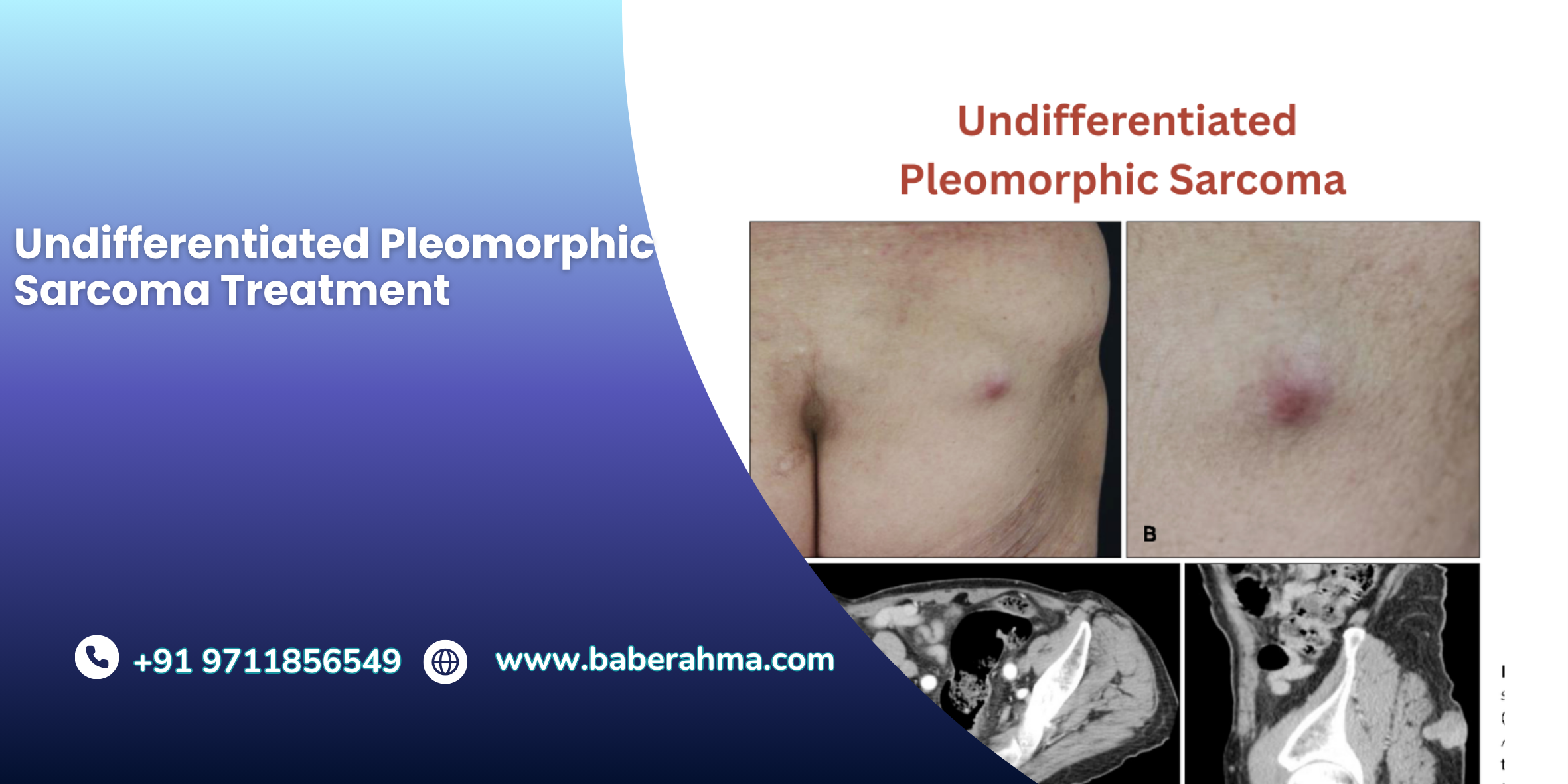 Procedure Image