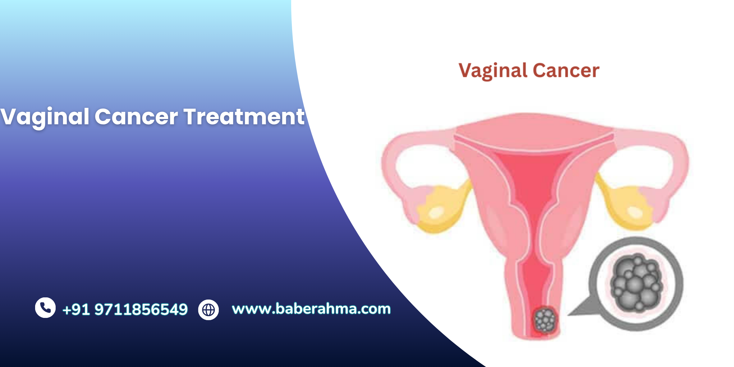 Procedure Image