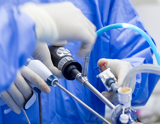 Neonatal and Paediatric Laproscopic Services