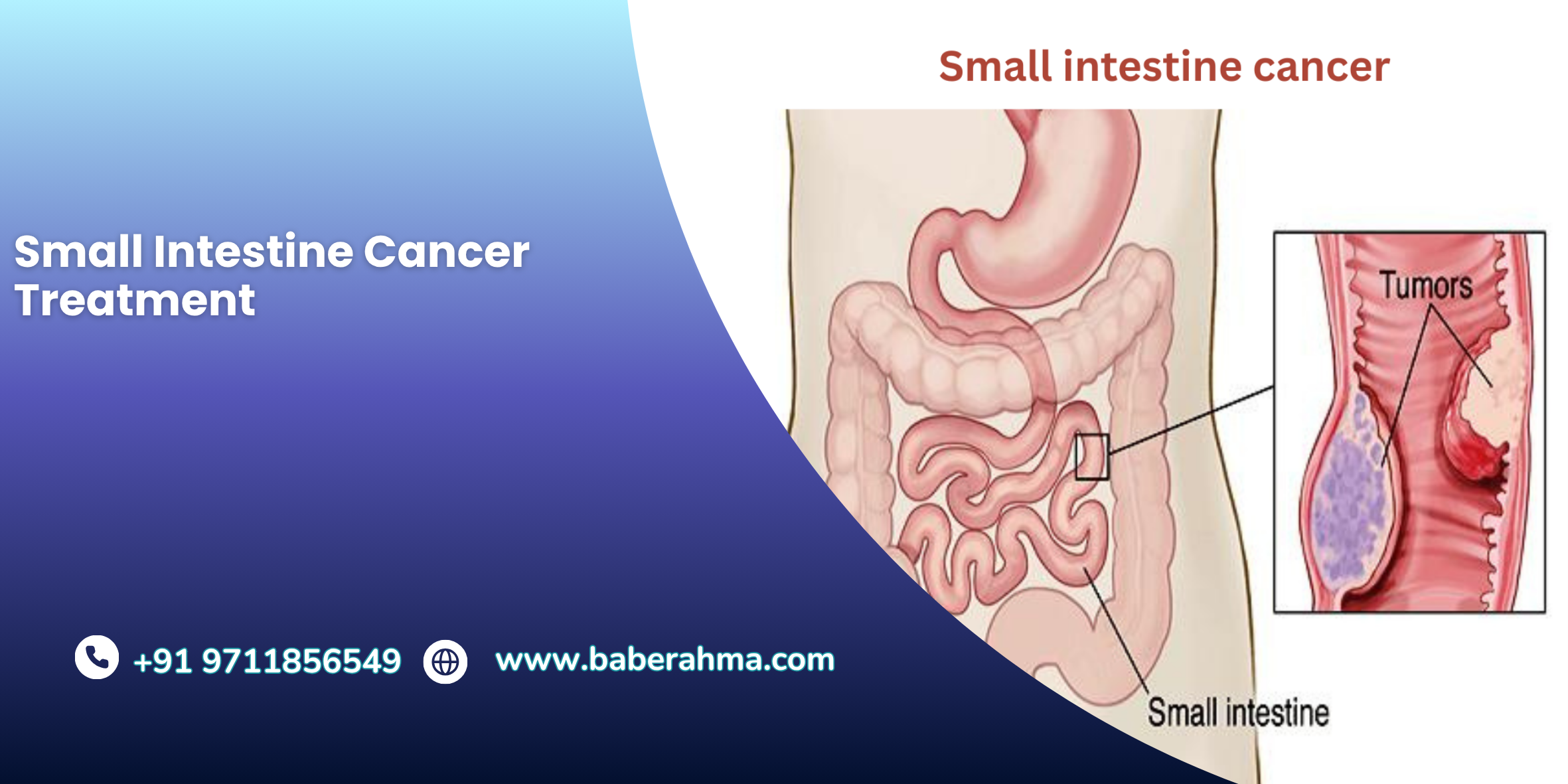 Procedure Image