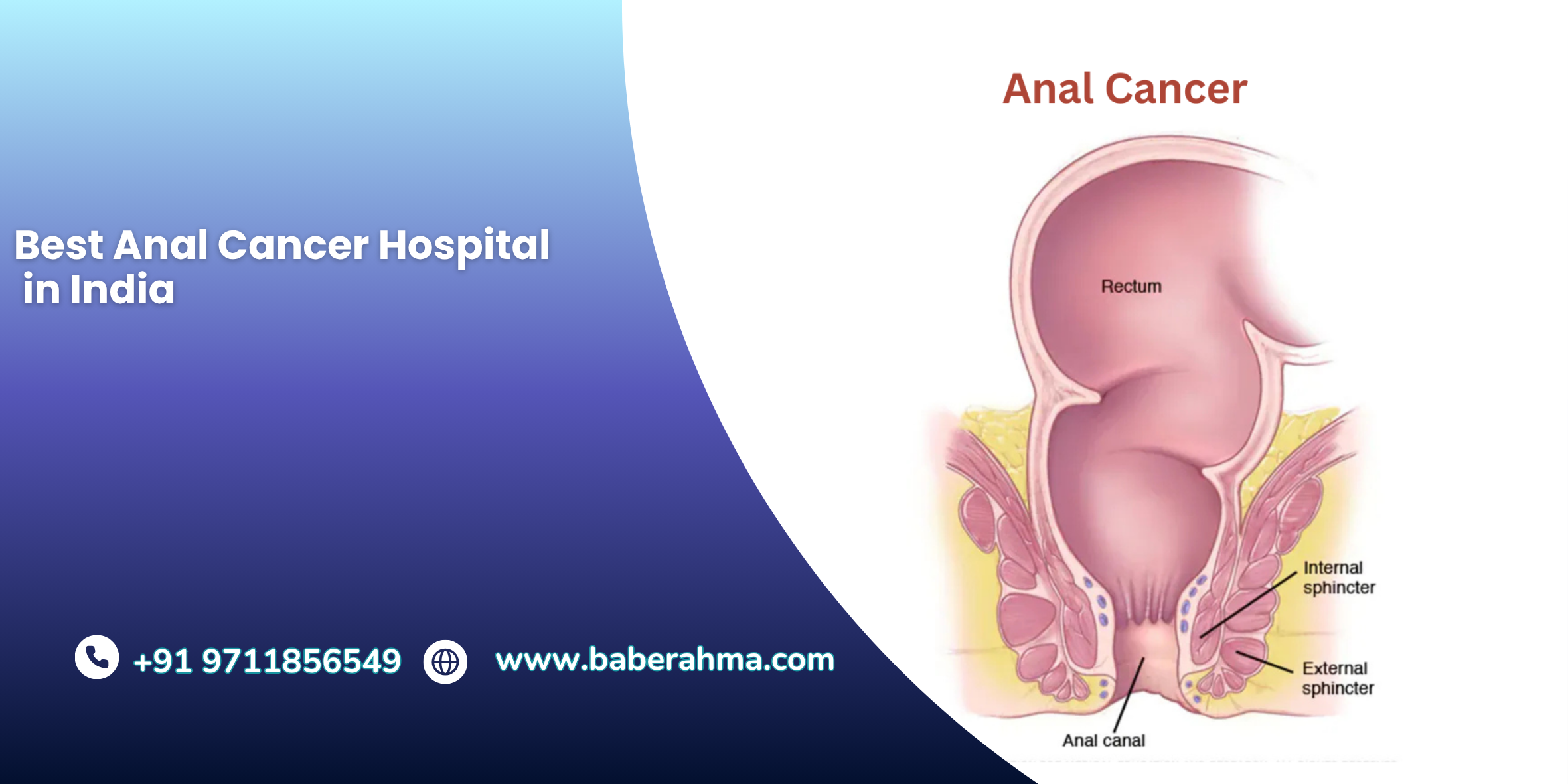 Procedure Image
