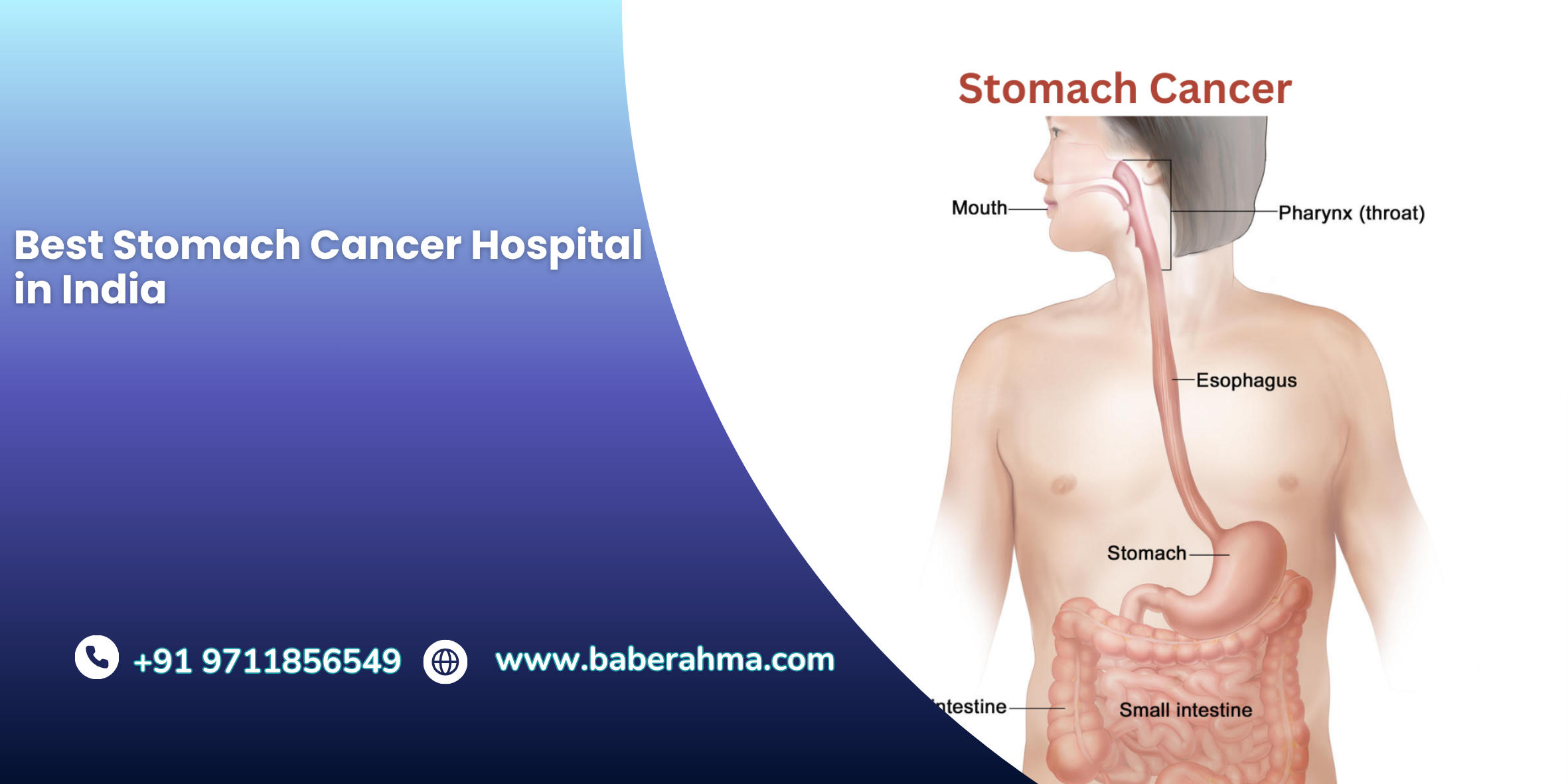 Procedure Image