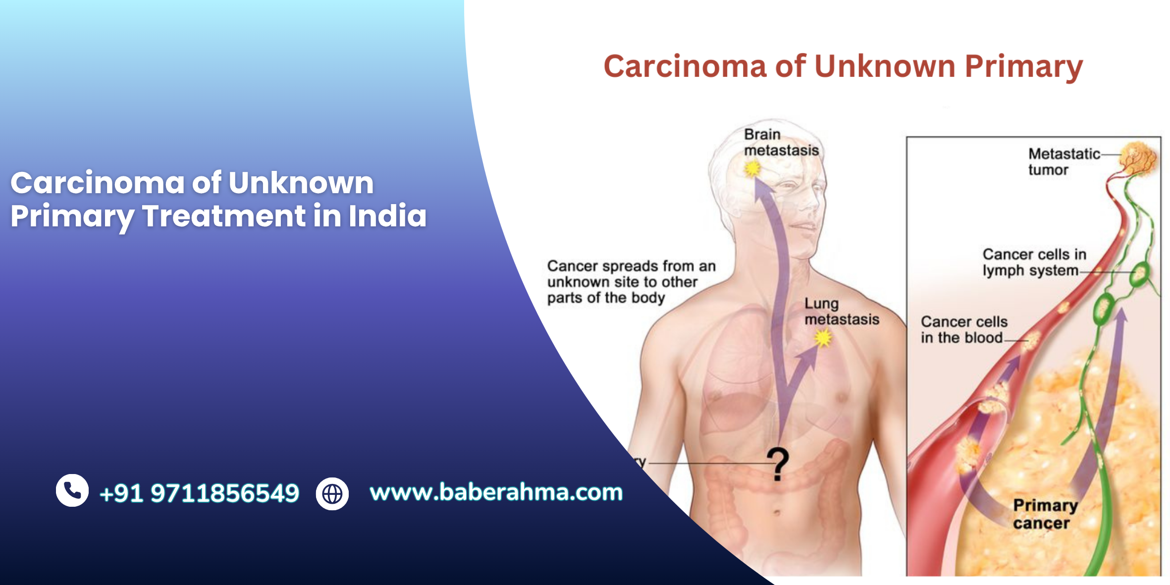 Procedure Image