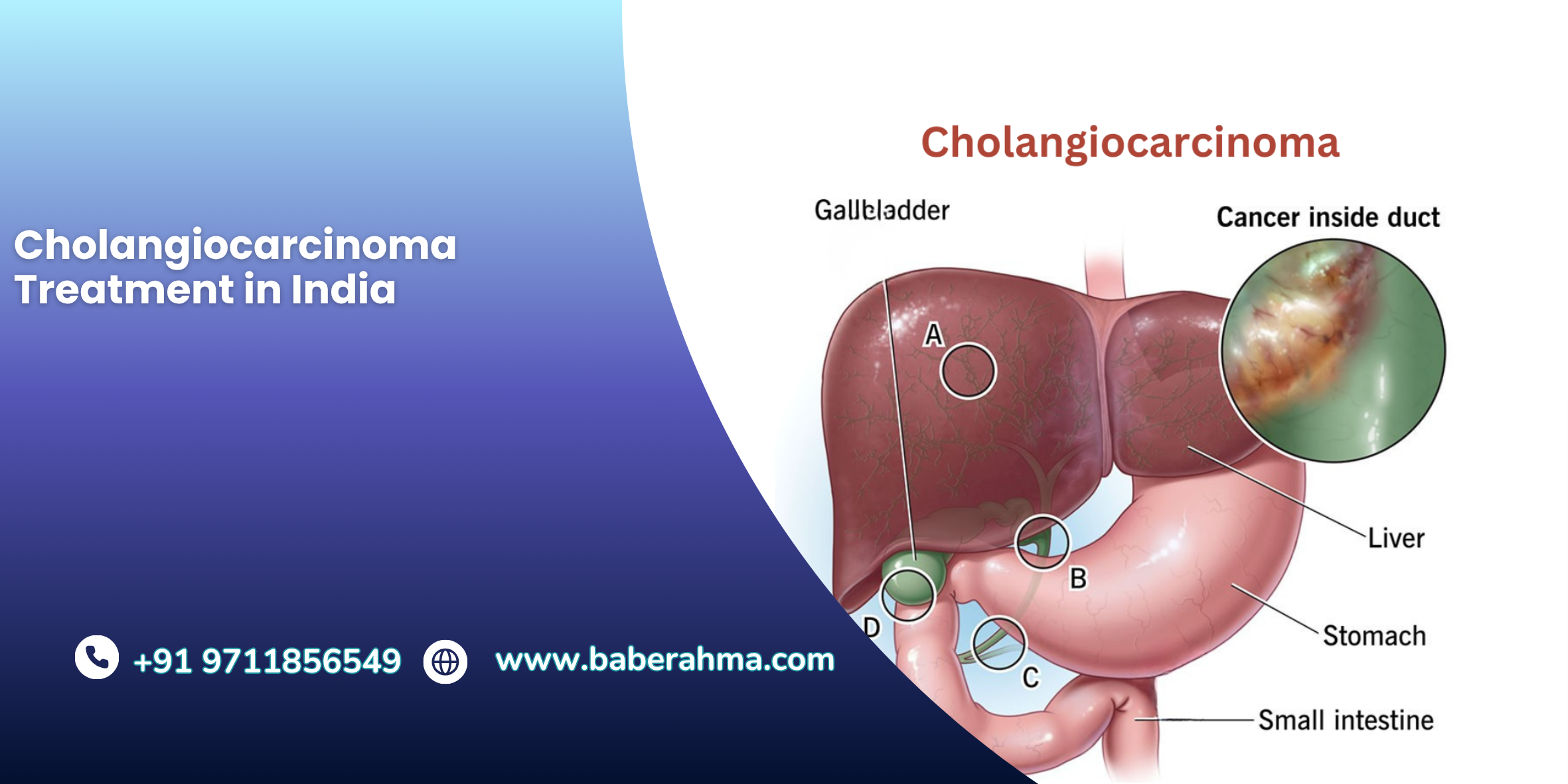 Procedure Image