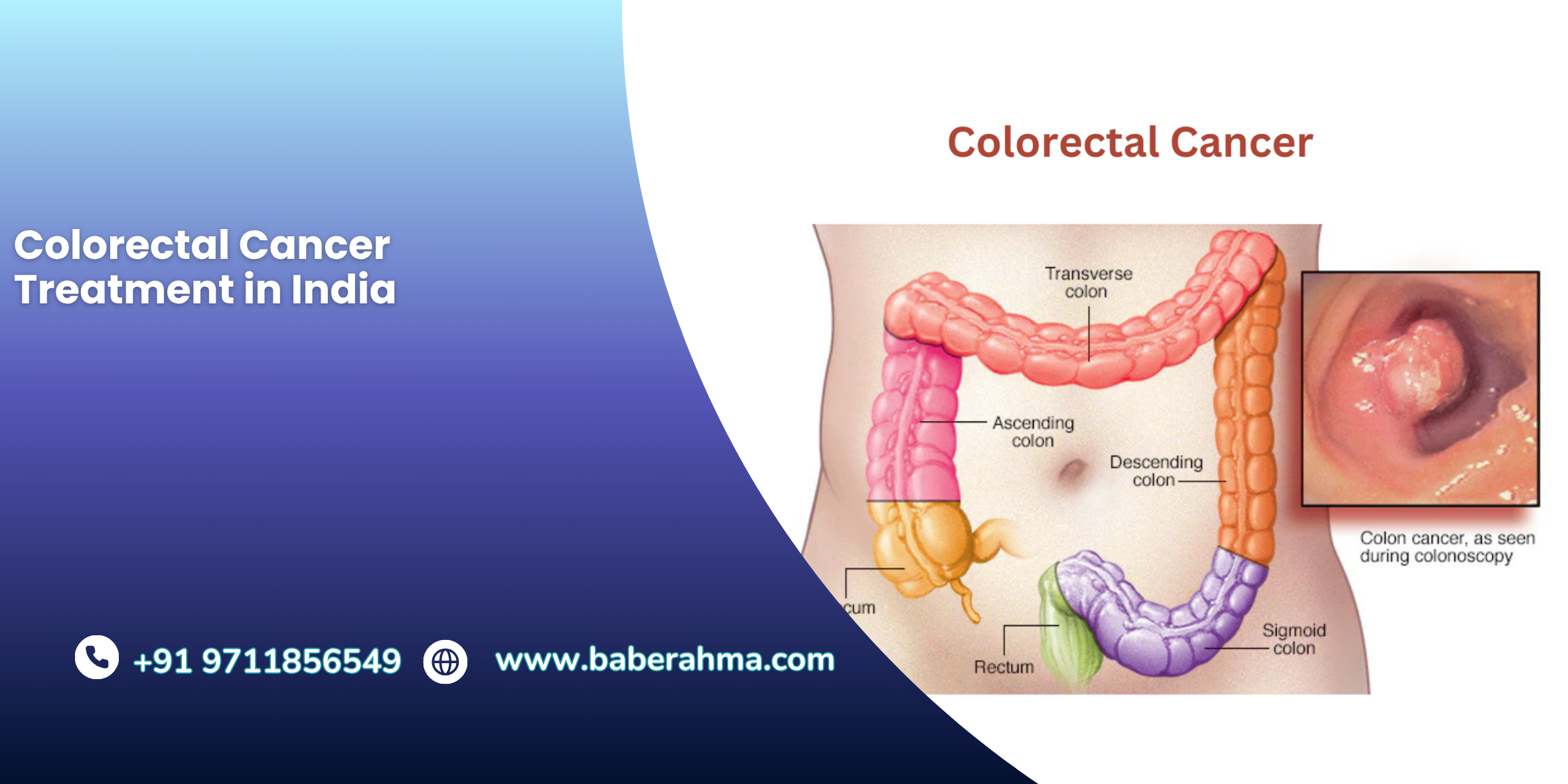 Procedure Image