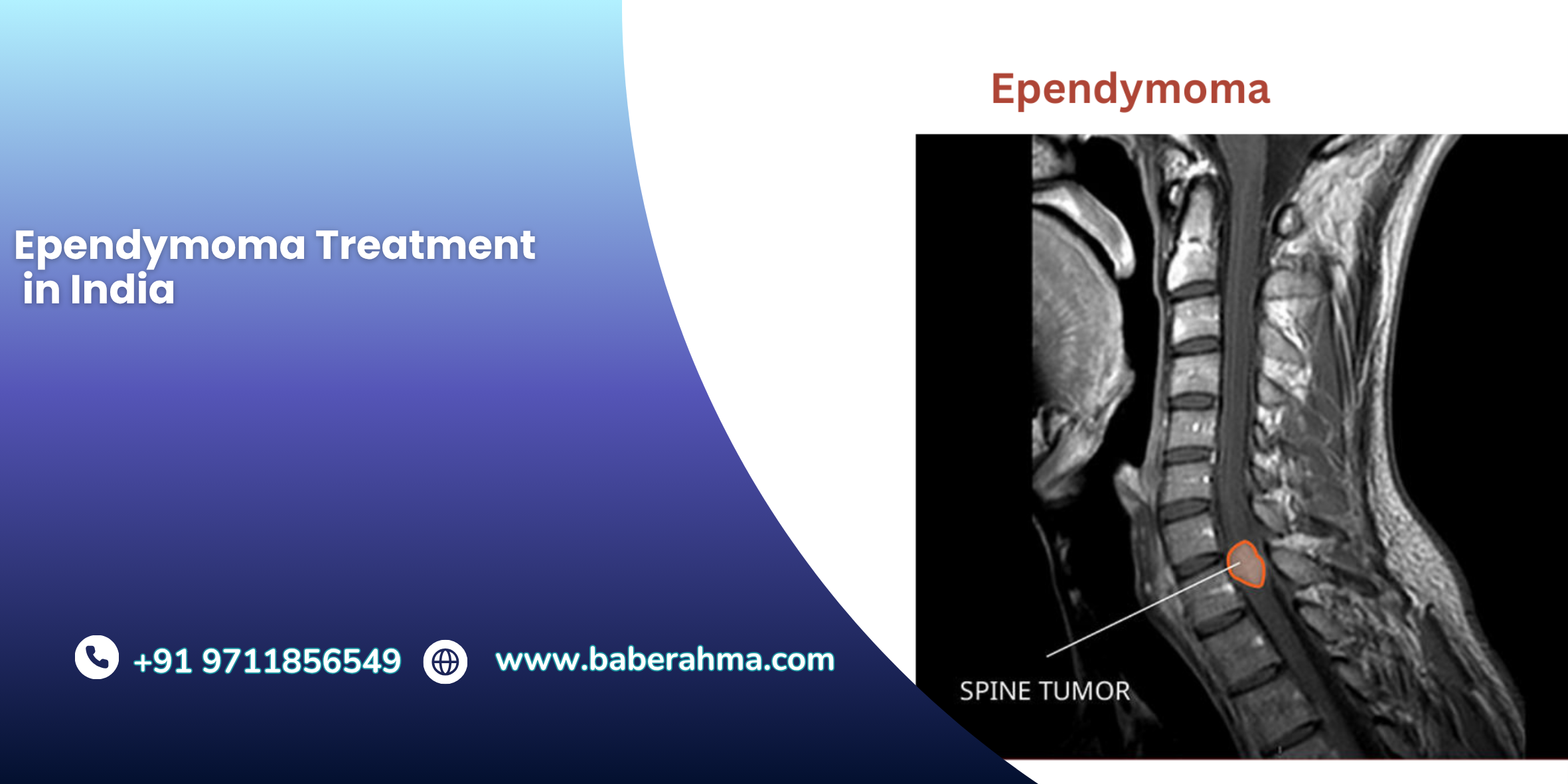 Procedure Image