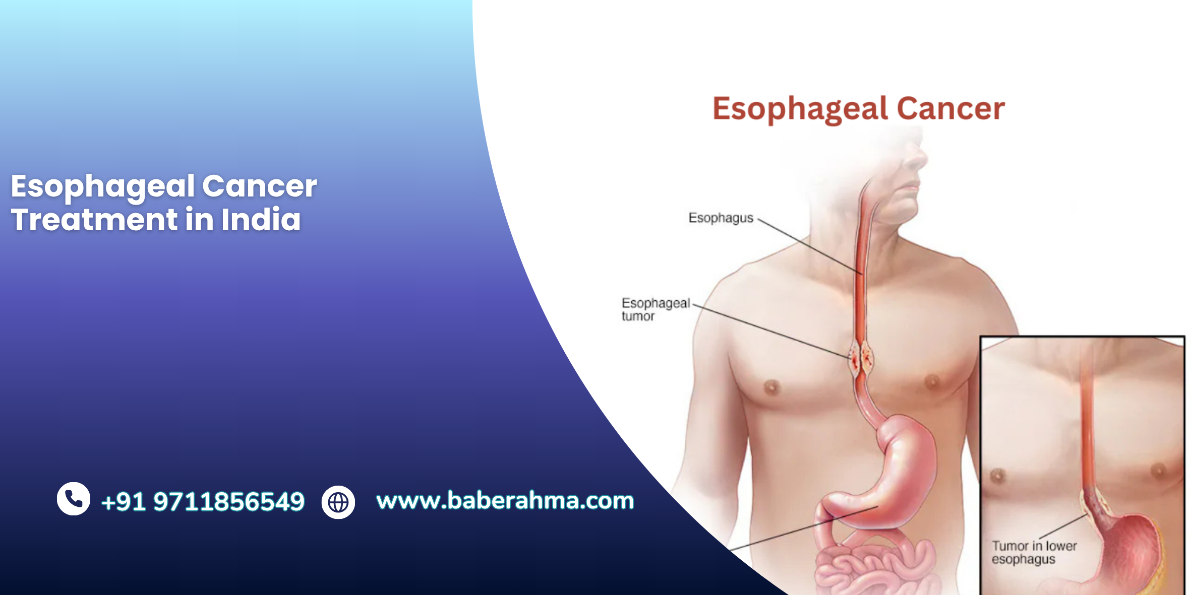 Procedure Image