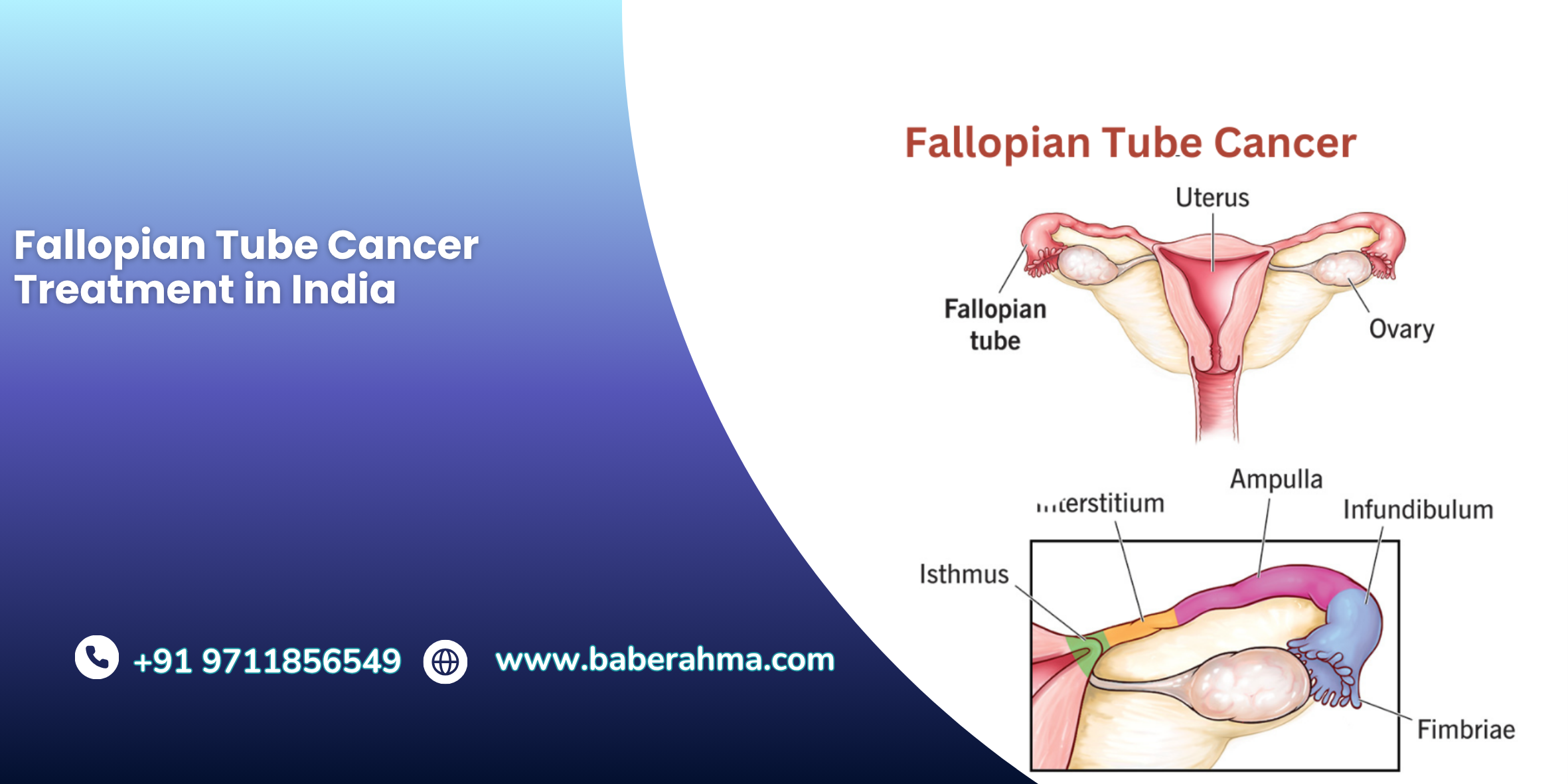 Procedure Image
