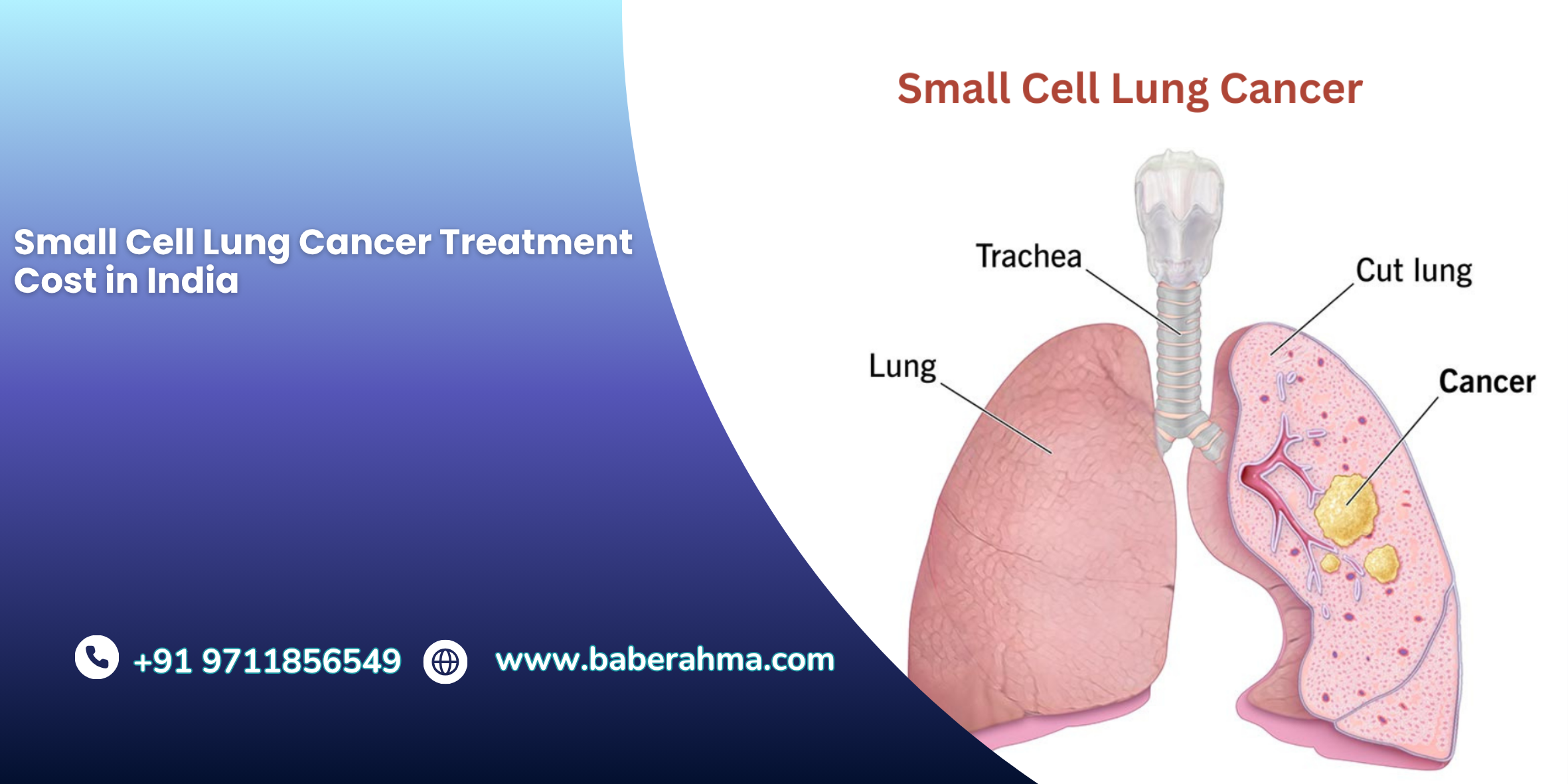 Procedure Image