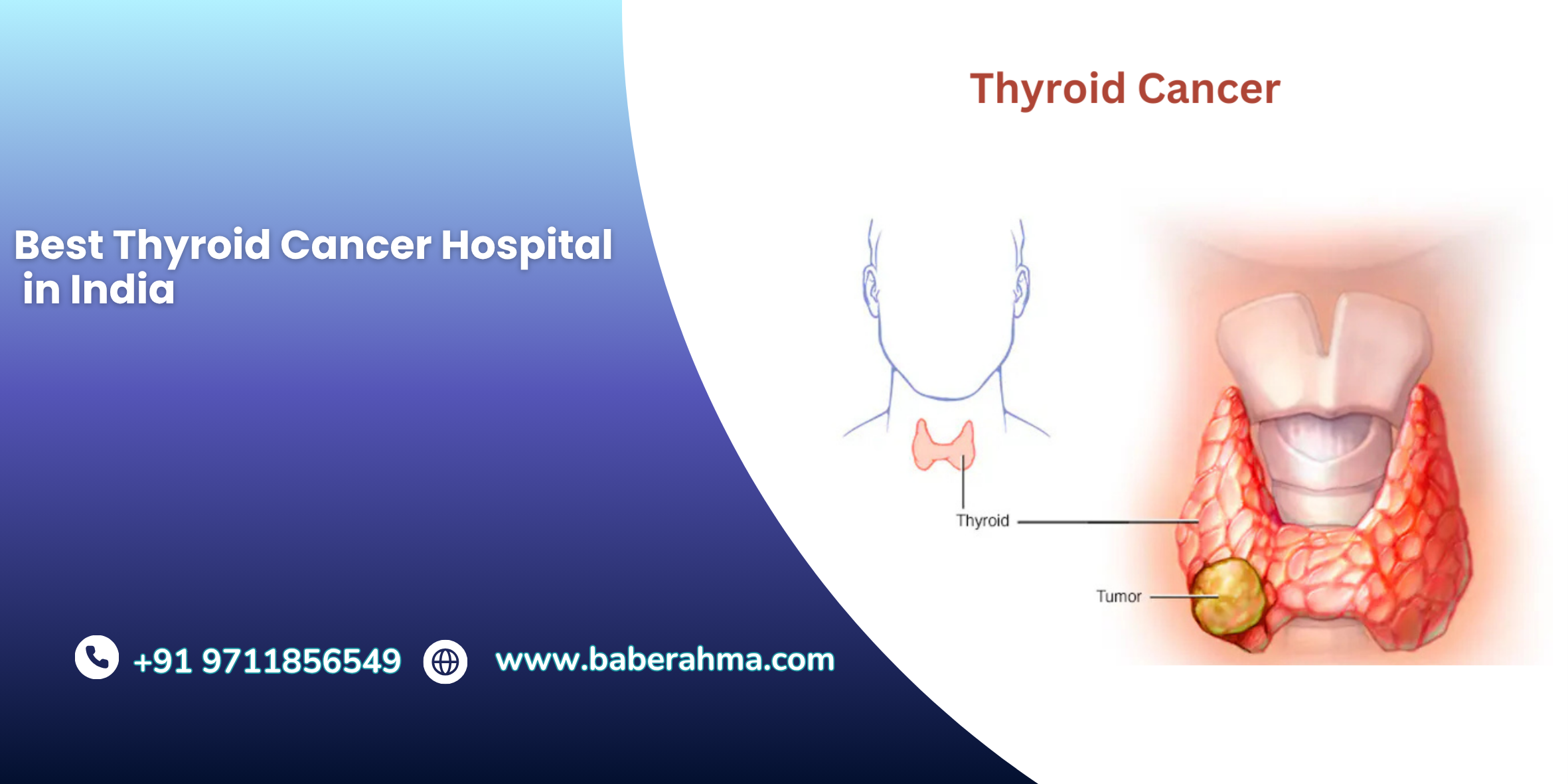 Procedure Image