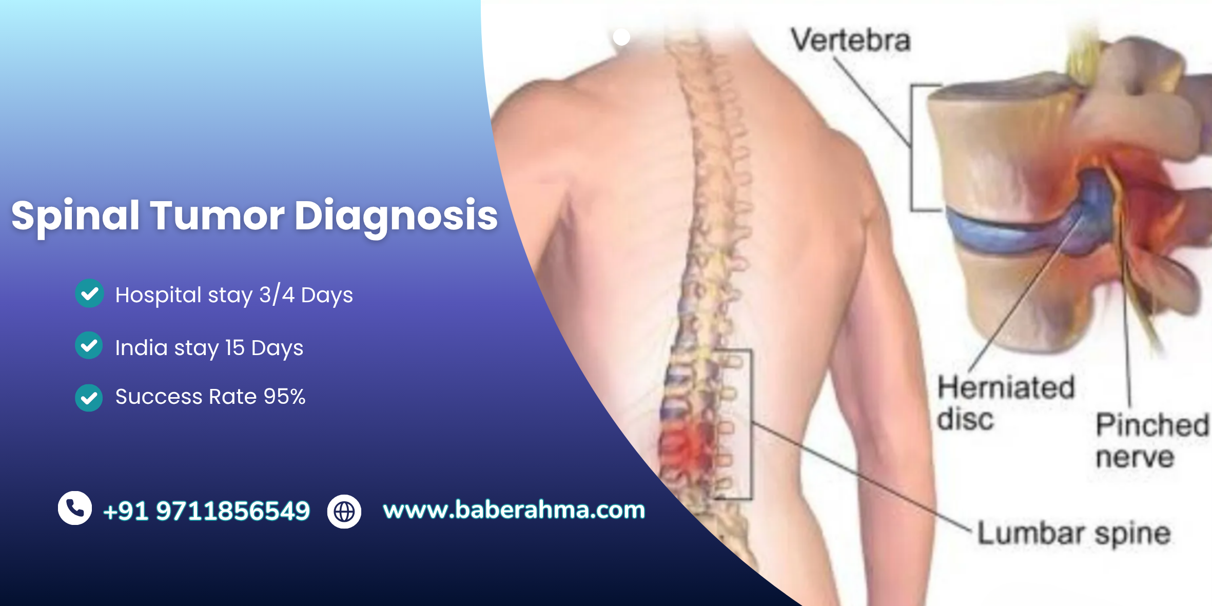 Procedure Image